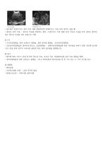 여성간호학 모성간호학 자궁경부암 자궁내막암 요약정리-6