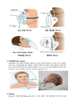 산소요법 간호분담과제-4
