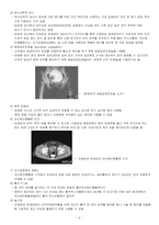 [성인간호학실습] 방광암 간호과정보고서-6
