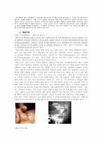 [성과사회]동성애, 트랜스젠더, 양성구유, 성전환에 대하여-3
