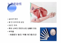 피임 레포트-3