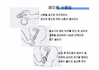 피임 레포트-9