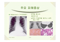 [대기오염]미세먼지-20