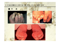[생물학과 인체생리학]미생물에 의한 질병-파워포인트-11