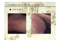 [생물학과 인체생리학]미생물에 의한 질병-파워포인트-12
