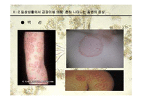 [생물학과 인체생리학]미생물에 의한 질병-파워포인트-13