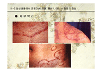 [생물학과 인체생리학]미생물에 의한 질병-파워포인트-14