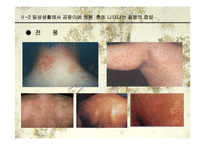 [생물학과 인체생리학]미생물에 의한 질병-파워포인트-15