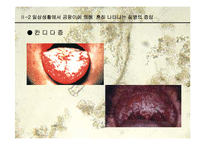 [생물학과 인체생리학]미생물에 의한 질병-파워포인트-16