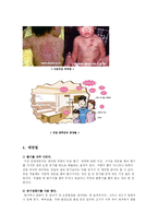 [환경] 새집증후군-4