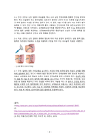아동간호학 case study+문헌고찰_신생아 선천성 심질환-4