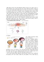 아동간호학 문헌고찰_아토피 피부염-2