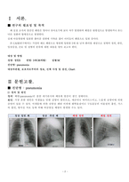폐렴케이스-아동간호학-3