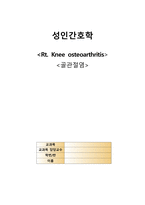 골관절염 사례-1