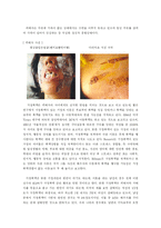 가정폭력의 문제점과 해결방안(1. 아내구타 2. 아동학대)-15