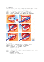 치면세마 칫솔질의 종류-2