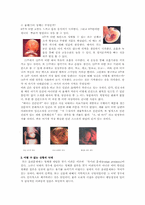 [사회윤리학]낙태의 후유증과 시술방법-2