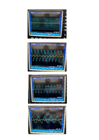(A+) 아날로그회로실험및설계 Op-Amp 미분기 실험 보고서-13
