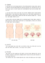 A+ 분만실 CS CASE-4