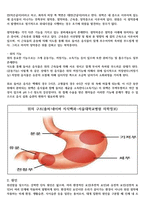 위암 간호사례연구(위암 케이스스터디, 폐렴 컨퍼런스) / 성인간호학-위암 실습-4