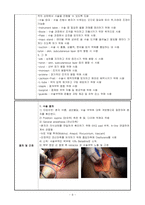 수술간호 실습 사례 보고서 위암 위절제술 영양 불균형 급성 통증-7