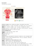8 자궁근종 (Uterine myoma)-2