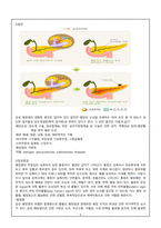 11 췌장염 (Pancreatitis)-4