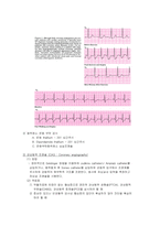 6 협심증 (Angina Pectoris)-7