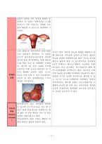 여성간호학실습 케이스스터디 자궁내막종 입니다. 간호진단 5개 간호과정 3개 입니다.복합적 요인(수술 통증, 빈혈)과 관련된 낙상 위험성, 복합적 요인(수술 통증, 입원 환경)과 관련된 수면장애, 침습적 처치와 관련된 감염위험성 3가지 간호과정 있습니다. -4