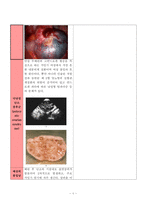 여성간호학실습 케이스스터디 자궁내막종 입니다. 간호진단 5개 간호과정 3개 입니다.복합적 요인(수술 통증, 빈혈)과 관련된 낙상 위험성, 복합적 요인(수술 통증, 입원 환경)과 관련된 수면장애, 침습적 처치와 관련된 감염위험성 3가지 간호과정 있습니다. -5
