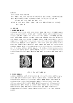 [간호 케이스] 경막하출혈 SDH 응급실케이스-3