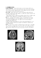 [간호 케이스] 경막하출혈 SDH 응급실케이스-4