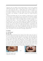 구개열의 의료적 접근-2