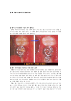 [유아 교육과정] 치아 교유계획안-14
