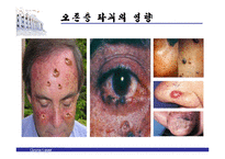 [자연과학 - 오존층] 오존층 파괴의 원인 과정 현황 대책-12