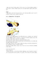 [소아과] 호흡기도내의 이물-3