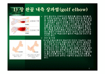 주관절 손상의 재활-5