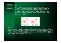 주관절 손상의 재활-7