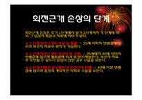 견관절의 이해 레포트-5