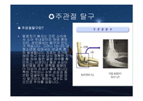 주관절의 손상과 재활-12
