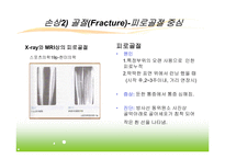 스포츠 손상과 치유과정-9