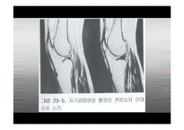 슬관절(무릎관절)-16