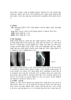 대퇴골절 케이스스터디-3