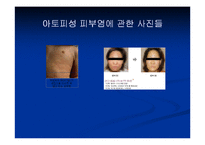새집증후군 레포트-10
