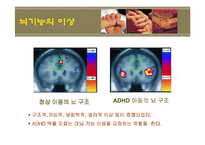 [정서장애아교육] 정서장애의 이해와 실제 -신체,생리학적 모델-14