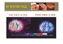 [정서장애아교육] 정서장애의 이해와 실제 -신체,생리학적 모델-15