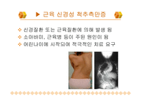 [스포츠] 척추측만증-11