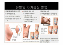 유방암에 대해서-15
