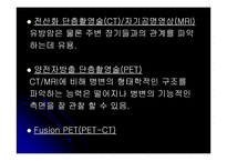 유방암에 대해서-18