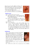 [간호학] 모성간호학 성전파성질환, 기타 감염성질환 레포트-2